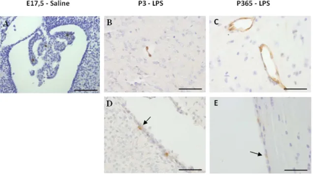 Figure 8  LCN2 immunoreactivity in the brain of control and LPS animals. LCN2 staining was restricted to the CP,  ependymal layer lining the ventricles and blood vessels