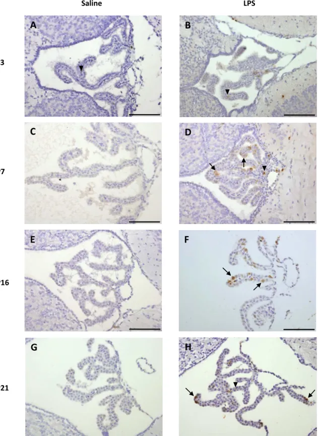 Figure 9  Immunohistochemistry for LCN2 in the choroid plexus of LPS and saline injected animals