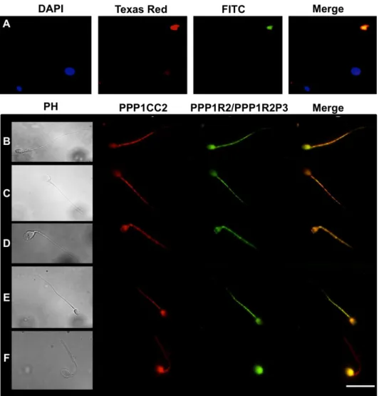 Figure  II.A.  7:  Co-localization  of  PPP1CC2  and  PPP1R2/PPP1R2P3  in  morphologically  normal  and  abnormal  spermatozoa