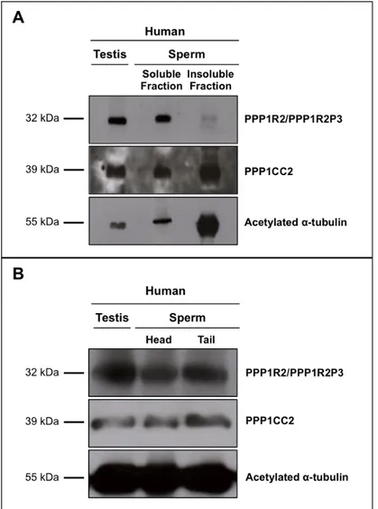 Figure  II.A.  8:  PPP1R2/PPP1R2P3  are  present  in  human  testis  and  sperm  extracts