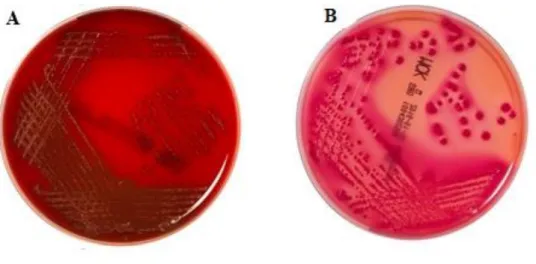Figura 1 - A) Meio de cultura agar sangue com crescimento de Staphylococcus spp. B) Meio de cultura  agar MacConkey com crescimento de E