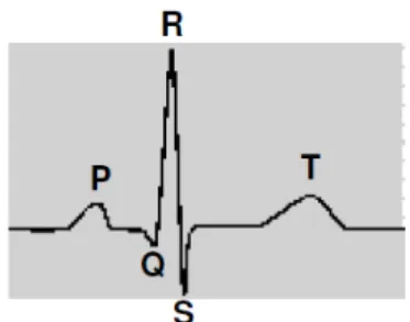 FIGURA 11. Representação de um traçado eletrocardiográfico típico de peixes  teleósteos