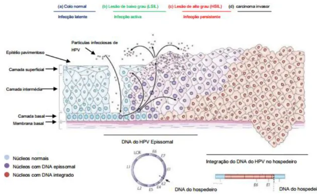 Figura 3 – O vírus do papiloma humano infeta as células da membrana basal através de lesões no epitélio