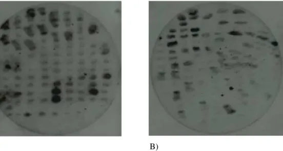 Figure III.5: Identification of putative Nek2 positives by colony hybridization: A) YTH1, B) YTH2