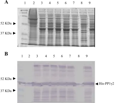Figure II.2: Small scale expression for detection of His-tagged PP1γ2  A . Coomassie blue  stained