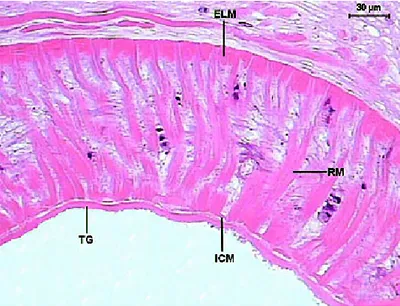 Figure 14. Detail of the Sticholecitha  serpentis acetabulum. ELM – external  longitudinal musculature, ICM – internal circular musculature, RM – radial  musculature, TG – tegument