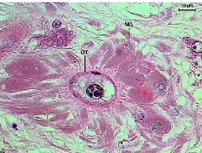 Figure 17. Detail of the Sticholecitha  serpentis ootype (OT) and Mehlis’ gland (MG). 