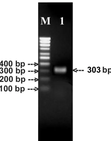 Figure 7. Amplification of the conserved region of the cytolysin gene by RT-PCR.  