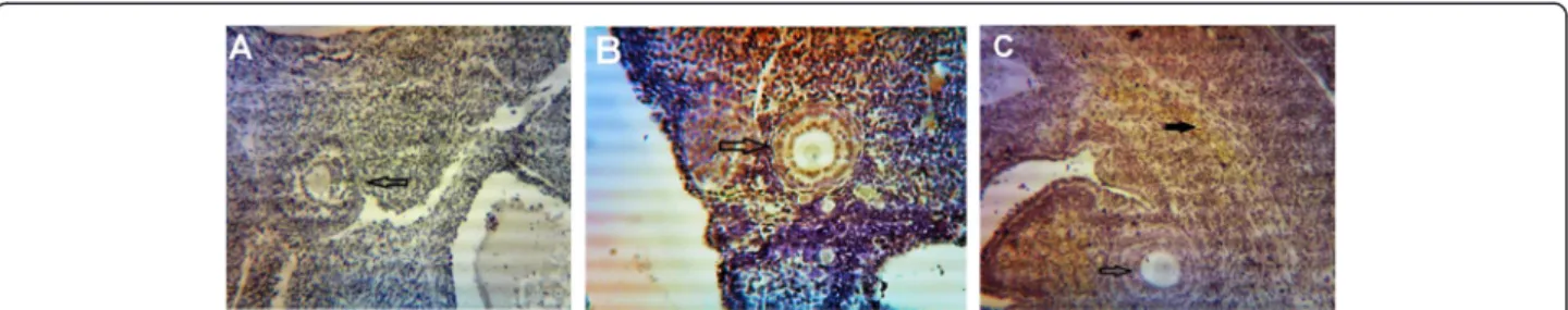 Figure 2 Expression of COX-2 in primary and secondary follicles. (A) normal ovary; (B) strict expression of COX-2 is observable in these folli- folli-cles in PCOS group; (C) COX-2 expression is restricted to blood vessels and ovary stroma (filled arrow) in