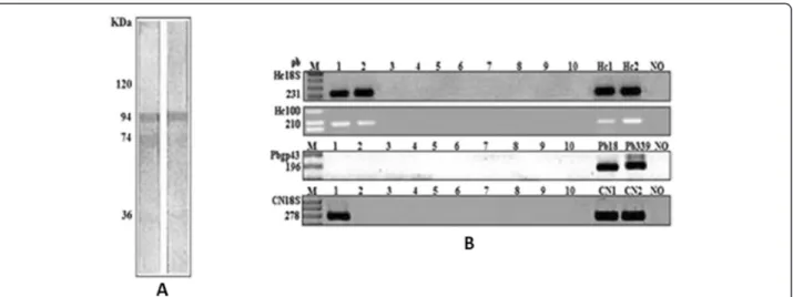 Figure 1 Immunoblotting and PCR assays. (A): Immunoreactivity of serum patient against H and M fractions of H