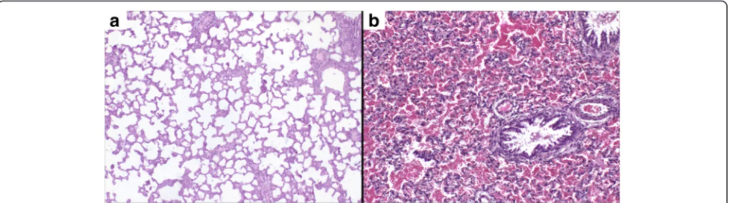 Fig. 4 Histopathology of the lungs. (a) Lungs of control rats showing no alterations and (b) lungs with diffuse hemorrhage of animals injected with 750 μg of H
