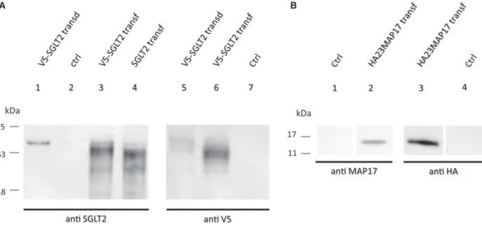 Fig. 1. Western blot analysis of heterologous expression of SGLT2 and MAP17 constructs in HEK293T cells