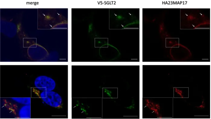 Fig. 2. Confocal immunofluorescence imaging of representative X-Y planes of heterologous cellular systems expressing SGLT2 and MAP17 constructs