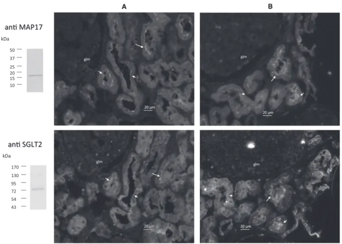 Fig. 4. Constitutive SGLT2 and MAP17 expression in the human kidney. Consecutive kidney sections immunolabeled with goat anti-MAP17 (top panel) or SGLT2 (bottom panel) antibodies are shown