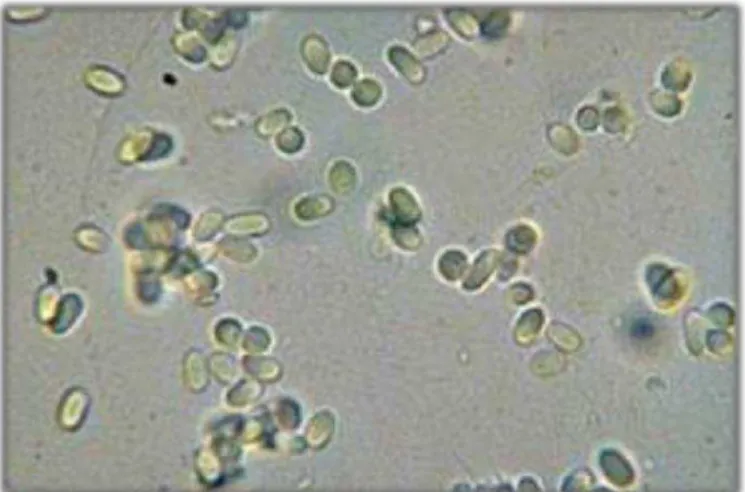 Figure 6. Spores of the fungus of the genus Nosema (Source: https://www.wur.nl/en/Expertise-  Services/Research-Institutes/plant-research/Biointeractions-Plant-Health/Bees-1/Bee- 