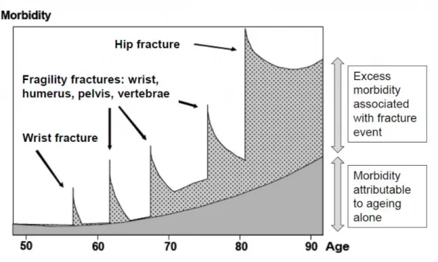 Figure 2. Schematic representation of the morbidity associated with different fractures with age  (adapted and reproduced from Bone Health and Osteoporosis: A Report of the Surgeon General [15]) 