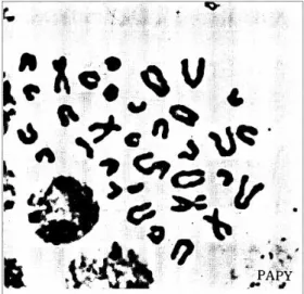 Figura 7:  Metáfase de Papyrocranus afer com 2n=34 cromossomos, segundo Uyeno  (1973)