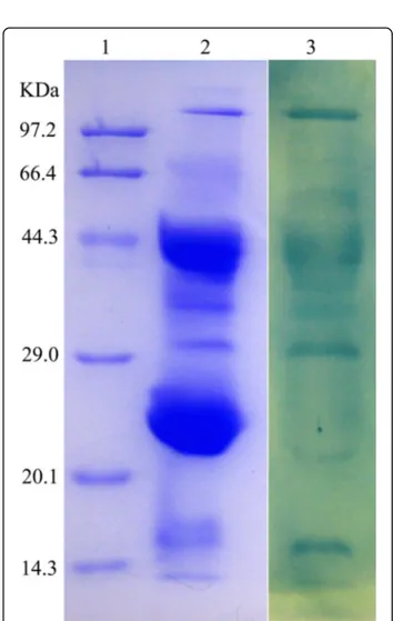 Fig 5 Antigen recognition repertoire of anti-D. acutus venom IgY by Western blot. Lane 1: Molecular weight marker on SDS-PAGE.