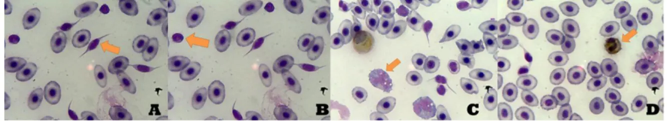 Figure  10 –  During  the  microscope  observation  after  the  stain  of  the  slide,  these  were  the  primarily  identified white blood cells