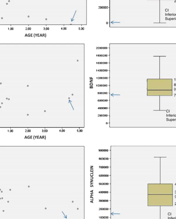 Fig. 2. Distribution of A ␤ , BDNF and AS values in the patient (arrows) and in controls