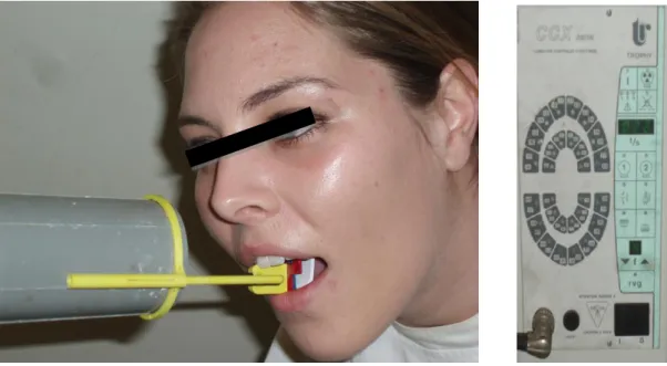 Figure 2: Paralleling technique using a film holder and exposure settings recorded for each subject  (authors´ property)
