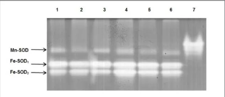 Figura 4. Actividad de teñido para la GR en gel de poliacrilamida donde línea 1 es standard de Saccharomyces cerevisiae GR; línea 2-4 hojas  con 0, 50 y 100 mg/kg de PbAc 2  respectivamente; línea 5-7 tallos con 0, 50 y 100 mg/kg de PbAc 2  respectivamente