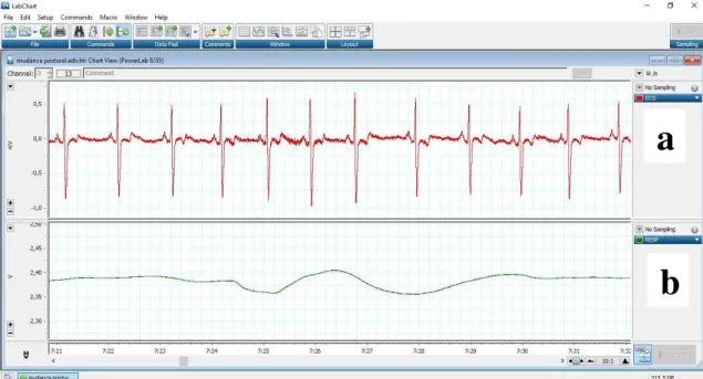Figura 3 - Ilustração da tela de captação dos sinais. A imagem ilustra a tela de captação  dos sinais eletrocardiográficos (Figura 3a) e do sinal de respiração (Figura 3b) obtidos por  meio do software LabChart 8 (ADInstruments, Austrália) de um dos partic