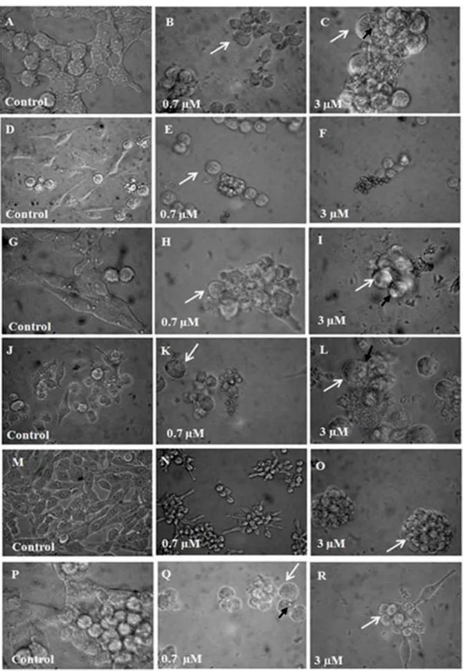 Figure 2. Morphological changes induced by leuc-B. Photomicrographs from phase-contrast microscopy of  the U87 (A-C), RT2 (D-F), T98 (G-I), Ehrlich (J-L), MCF7 (M-O), UACC (P-R) tumor cells