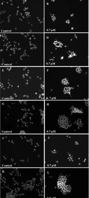 Figure  3.  Analysis  of  nuclear  condensation  of  U87  (A-B),  RT2  (C-D), T98  (E-F),  Ehrlich  (G-H),  MCF7  (I-J)  and UACC (K-L) tumor cells: Cells were treated with  0.7 µM of leuc-B