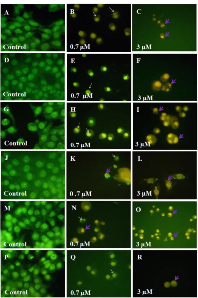 Figure 4. Analysis of cell death induced by leuc-B on U87 (A-C), RT2 (D-F), T98 (G-I), Ehrlich (J-L), MCF7 (M-O)  and UACC (P-R) tumor cells