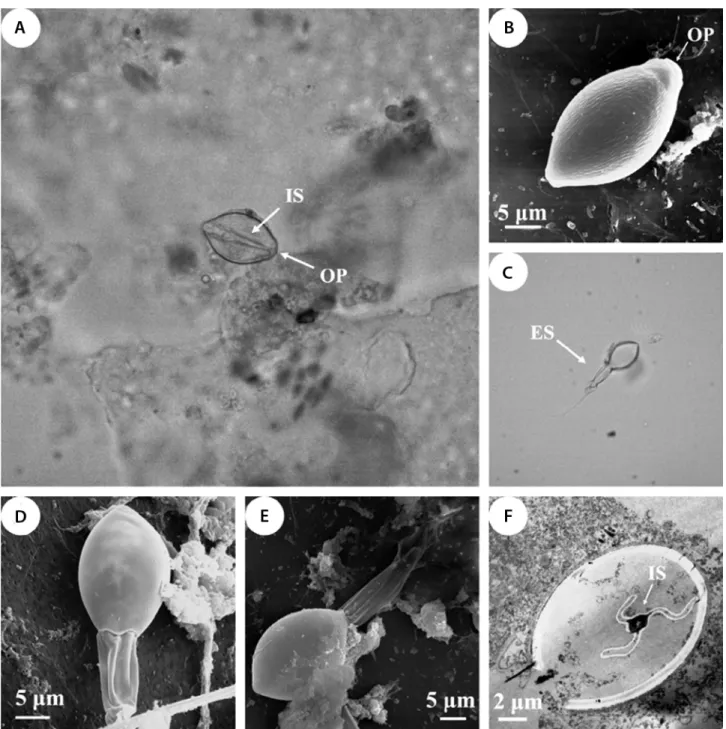Figure  2.  (A)  LM  image  of  an  undischarged  stenotele  isolated  from  Millepora  complanata   showing  the  operculum  (OP)  and  the  inverted  shaft  (IS),  magnification  400x