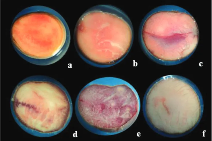 Figure 1.  Viability classes of Eugenia uniflora L. (Surinam  Cherry) found in tetrazolium test: (a) viable seed  with homogeneous light pink color; (b and c)  viable seed with light pink color in more than 50% 