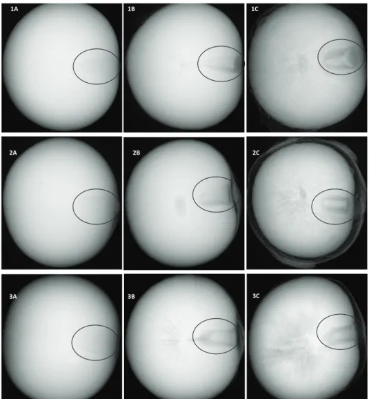 Figure 1.  Representative image of the reduction of the volume occupied by the embryo within the embryo cavity throughout the drying  process