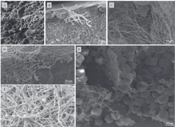 Figure 6.  Electron micrographs of the inner parts of a maize seed inoculated with Stenocarpella macrospora during different  periods