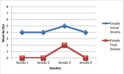 Figura  17:  Paciente  F  -  Evolução  da  intensidade  de  dor  ao  longo  das  quatro  sessões  de  acupunctura, do  lado direito