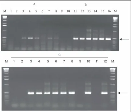 Figura 1. Teste do método de extração de RNA total. Nas colunas 1 a 8 (A) foi utilizado o método de extração de RNA total proposto por Weilguny &amp; Singh (1998)