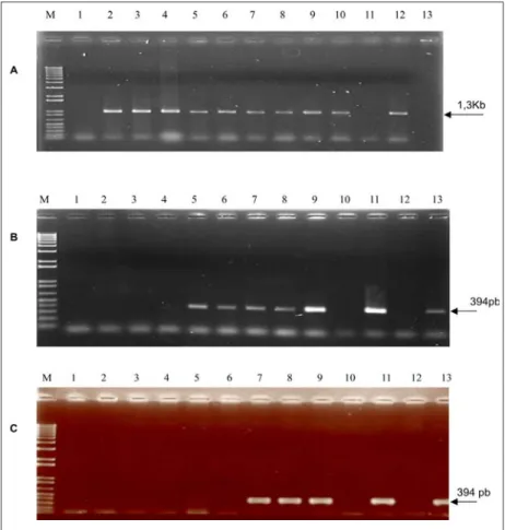 Figura 2. Gel demonstrativo do teste de diferenciação de estirpes em agarose 2%. A combina- combina-ção de primer utilizada para A, foi PY2/ PY1, PY2 (RT/ PCR)