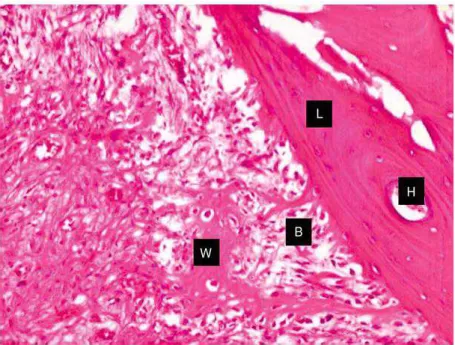 Figura  2.2  Imagem  microscópica  de  tecido  ósseo.  W:  tecido  ósseo  primário/imaturo;  B: osteoblastos;  L: tecido secundário/ osso lamelar;  H: 