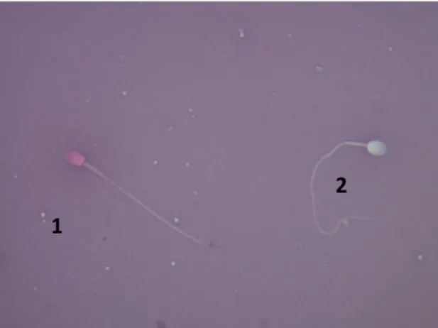 Figura  3.  Integridade  da  membrana  plasmática.  (1)  Espermatozoide  com  membrana  plasmática  lesada; (2) Espermatozoide com membrana plasmática íntegra