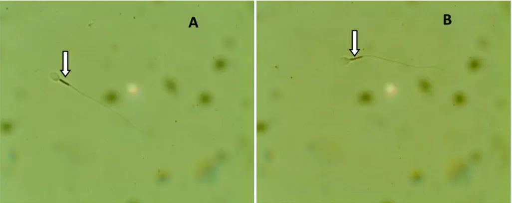 Figura 5. Atividade citoquímica mitocondrial. As setas indicam a deposição de DAB  na peça intermediária, onde estão localizadas as mitocôndrias