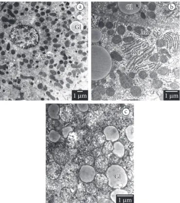 Figure 2. a)Hepatic Transmission Electron Microscopy (TEM) images  of rats that received supplementation with linoleic acid; b) AdvantEdge®