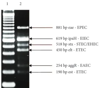 Figure 1. 2% Agarose Gel Electrophoresis. Visualization of amplified  genes used as positive controls in multiplex PCR.