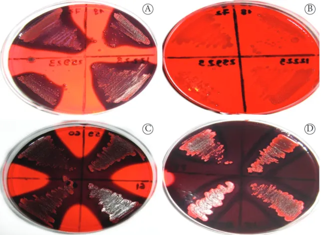Figure 1. Colonies of Staphylococcus strains producing exopolysaccharide on Congo red agar with 50 g/l of sucrose