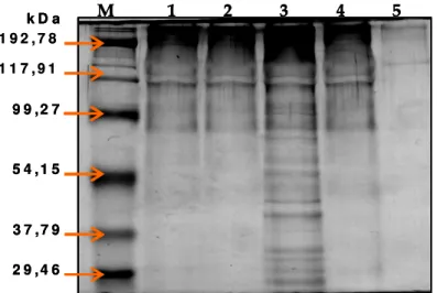 Figura 3 - SDS-PAGE da hidrólise do colagénio humano do tipo I pelos PE de A. hydrophila CECT  839T