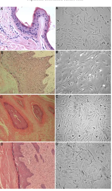 Figure 1. Histological appearances of papillomas (40x) and morphology of respective cultured cells (100x)