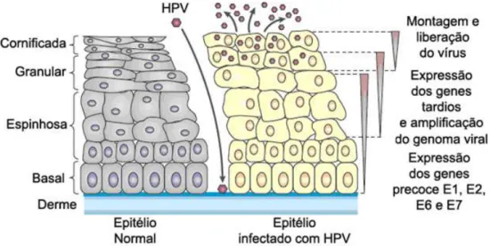 Figura 2Infecção pelo HPV. Através de regiões de microtrauma o HPV tem acesso às células da camada basal