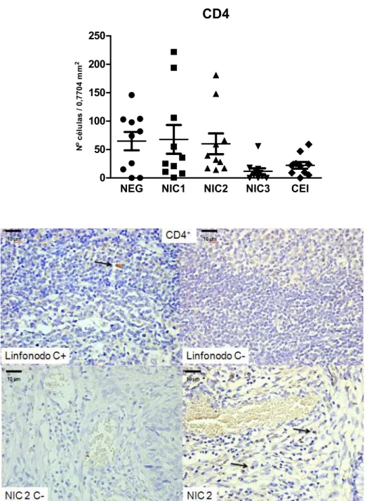 Gráfico  4  Número  de  células  CD4 +   frente  ao  diagnóstico  histológico.  (ANOVA  p&gt;  0,05).NEG,  negativo; 