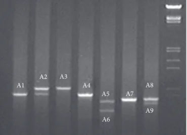 Figure  3.  Agarose  gel  (1,4%)  demonstrative  obttained  after  one  second  amplification  with  the  microorganisms  selected
