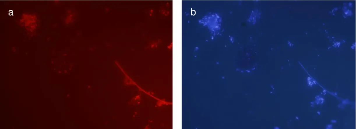 FIGURE 2. In situ identification of Bacteria Dominium after hybridization with Cy3 labeled probes  (a)