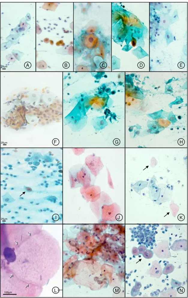 Figura 2: Fotomicrografias de esfregaços cérvico-vaginais corados pela coloração de      Papanicolaou